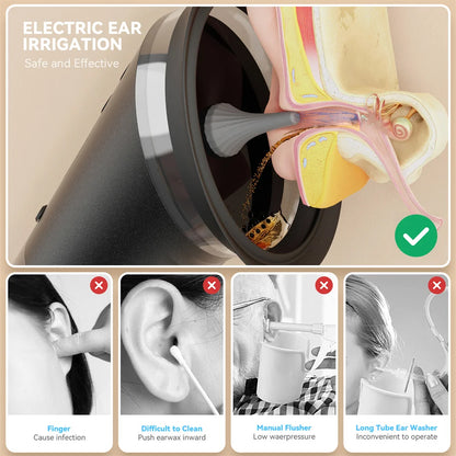 Electric Ear Wax Removal System Water Powered Ear Cleaning Tool with Irrigation Flusher 3 Pressure Settings Safe &amp; Effective