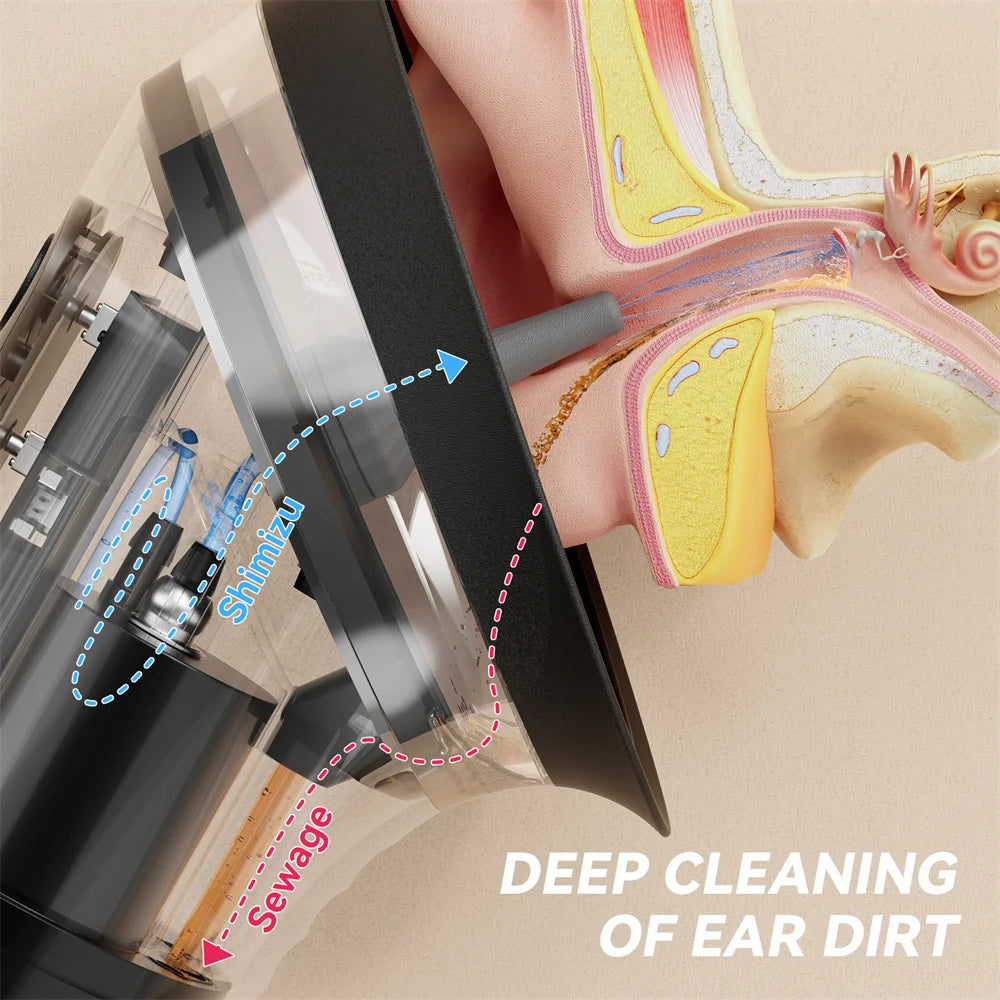 Electric Ear Wax Removal System Water Powered Ear Cleaning Tool with Irrigation Flusher 3 Pressure Settings Safe &amp; Effective